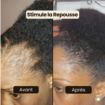 Huile de Croissance Capillaire